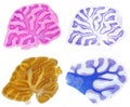 Cerebellum. Comparison of four stain methods