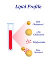 Components of Lipid profile Royalty Free Stock Photo