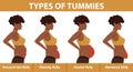 Four types of Tummies for African American women