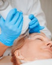 Fractional laser resurfacing - laser rejuvenation procedure