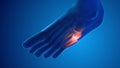 Fracture foot bone pain medical concept