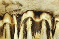 A fragment of jawbone with incisors background