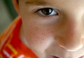 A freckle faced boy Royalty Free Stock Photo