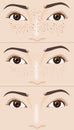 Freckle spots on the woman\'s face compare before and after skin treatment, illustration