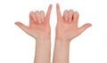 Freckled white hands. Hands make the shaka, dude, or surfer gesture, palms up