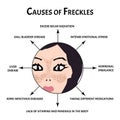 Freckles on the face of the cause. Pigmentation on the skin. A pigmented spot on the skin of the face. Vector