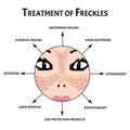 Freckles on the face. Pigmentation on the skin. A pigmented spot on the skin of the face. treatment. Vector illustration