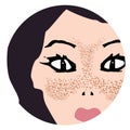 Freckles on the face. Pigmentation on the skin. A pigmented spot on the skin of the face. Vector illustration