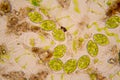 Pond water plankton and algae at the microscope. Spirogyra