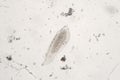 Freshwater zooplankton probably protozoan ciliated Ciliophora