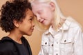 Friendly children, tender african and albino kids Royalty Free Stock Photo