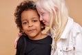 Friendly children, tender black and albino kids