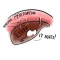 Frightened liver and adhesion to the peritoneum