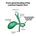 Front spiral bending of the common hepatic duct. Pathology of the gallbladder.