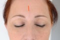 Close up of woman with acupuncture tool attached
