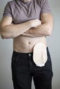 Front view on colostomy bag attached to man patient, medical theme. Skin color ostomy pouch close-up. Colon cancer surgery