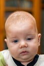 Front View of an Infant Boy with Ptosis and Possible Craniosynostosis Royalty Free Stock Photo