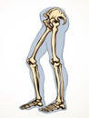 Vector drawing. Bones of the leg