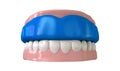 Gum Guard Fitted On Closed False Teeth Royalty Free Stock Photo