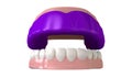 Gum Guard Fitted On Open False Teeth Royalty Free Stock Photo