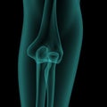 Front x-ray view of human elbow Royalty Free Stock Photo