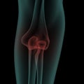 Front x-ray view of human painful elbow Royalty Free Stock Photo