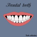 Frontal teeth