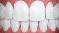 Frontal view on sparkling white anterior teeth