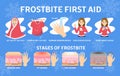 Frostbite first aid infographic. Hypothermia in cold winter Royalty Free Stock Photo