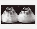 Full abdomen ultrasound sonogram Royalty Free Stock Photo