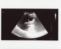 Full abdomen ultrasound sonogram Royalty Free Stock Photo