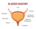 Full bladder. Urinary bladder with urine. Anatomy of the human organ. Medicine, healthcare and science. infographic