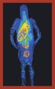 Full body medical scan