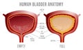 Bladder Anatomy scheme