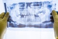 Full mouth panoramic in X-ray, showing all teeth Royalty Free Stock Photo