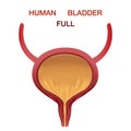 Full Urinary bladder. Human organ anatomy. Editable vector illustration in realistic style