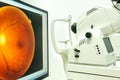 Fundus camera use for examination eye in hospital Royalty Free Stock Photo
