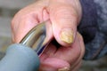 Fungal nail disease on the hands of an elderly person close up selective focus