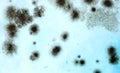 Fungal spores in the liquid. Viral bacterium. Fungal infection. Distribution and multiplication of fungi and bacteria