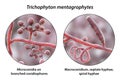 Fungi Trichophyton mentagrophytes, 3D illustration