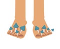 Fungus on feet. Mycosis between fingers. Disease of skin of fingers and feet