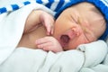 Funny baby face in hat,newborn with jaundice on white blanket, infant healthcare Royalty Free Stock Photo