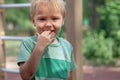 Funny cute blonde baby boy stands with fingers in mouth, smiling. Wound on the elbow, pretty real childhood. Royalty Free Stock Photo