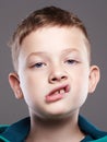 Funny kid. funny grimace emotion child Royalty Free Stock Photo