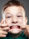 Funny kid. ugly grimace child Royalty Free Stock Photo