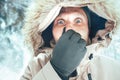 Funny man dressed in Warm Hooded Casual Parka Jacket Outerwear with frozen nose winter portrait. Health on winter time concept