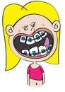 Funny white girl with dental braces cartoon