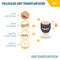 Hair transplantation by FUT method in men Royalty Free Stock Photo