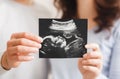 Future parents holding ultrasound scan of their future baby Royalty Free Stock Photo