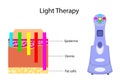 Gadget for Light Therapy and chart, vector illustration